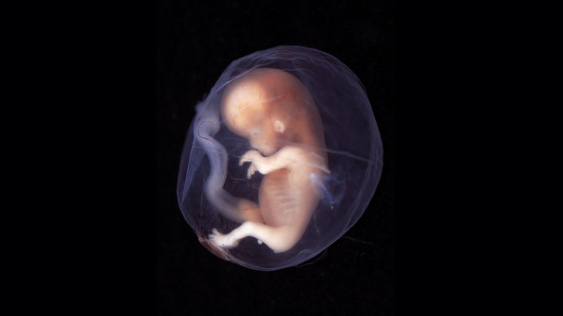 A Chi Apparteniamo? L’embrione Tra Radici E Alture